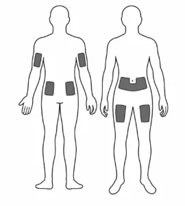Injection sites in the body