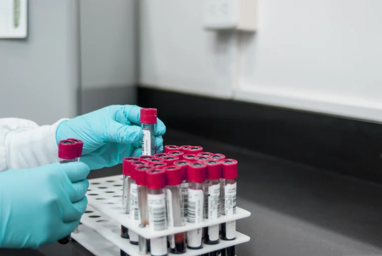 HbA1C Test: Normal Range, Blood Sugar Chart & Diabetes HBa1c Test